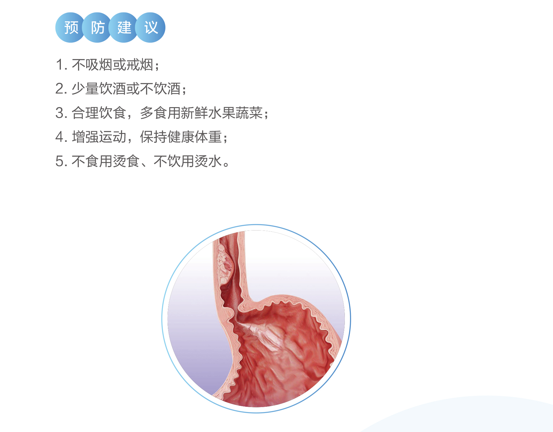 食管癌2.jpg