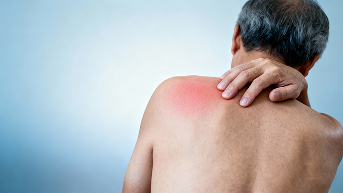 jimeng-2025-10-30-9197-中年男性背部特写，左侧肩膀有轻微红肿，右手按压肩膀表现疼痛，医学科普风格，冷色调....jpg